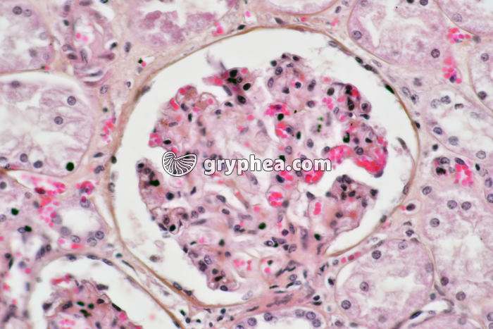 Rein x100 - gryphea.com